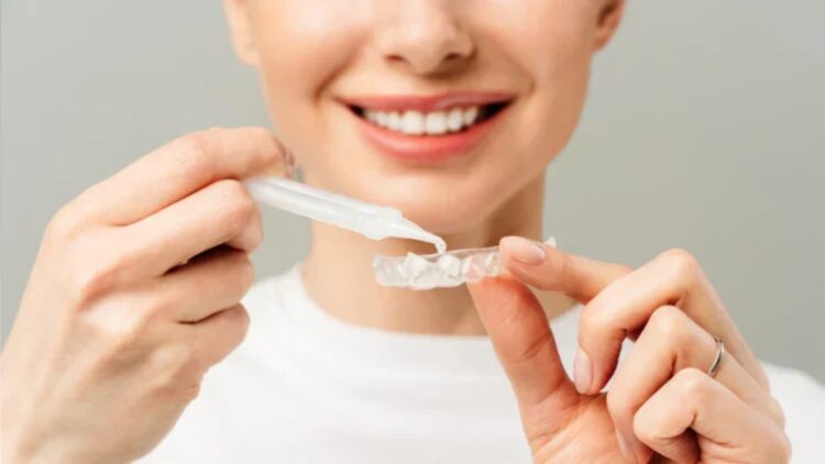 Dentists warn of the danger—the homemade peroxide method for whitening teeth that is sweeping social media and can leave you with permanent sensitivity