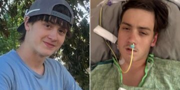 The dramatic case of Noah Johnson—a spider bite nearly cost a 16—year-old boy in Iowa his life