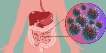 Neither a mild cold nor the common flu—norovirus is back with a vengeance, triggering outbreaks across the country